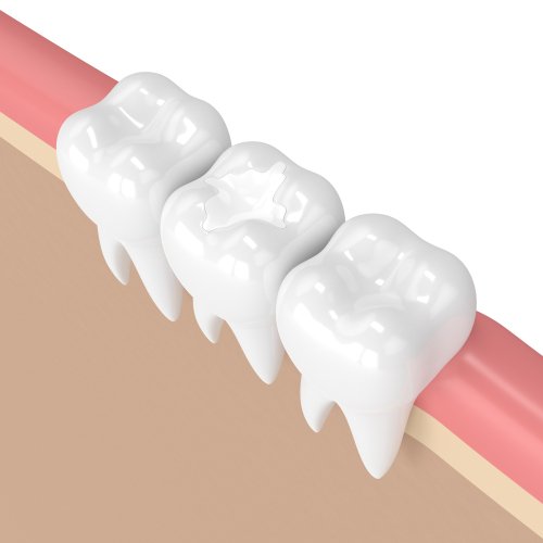 General Dentistry