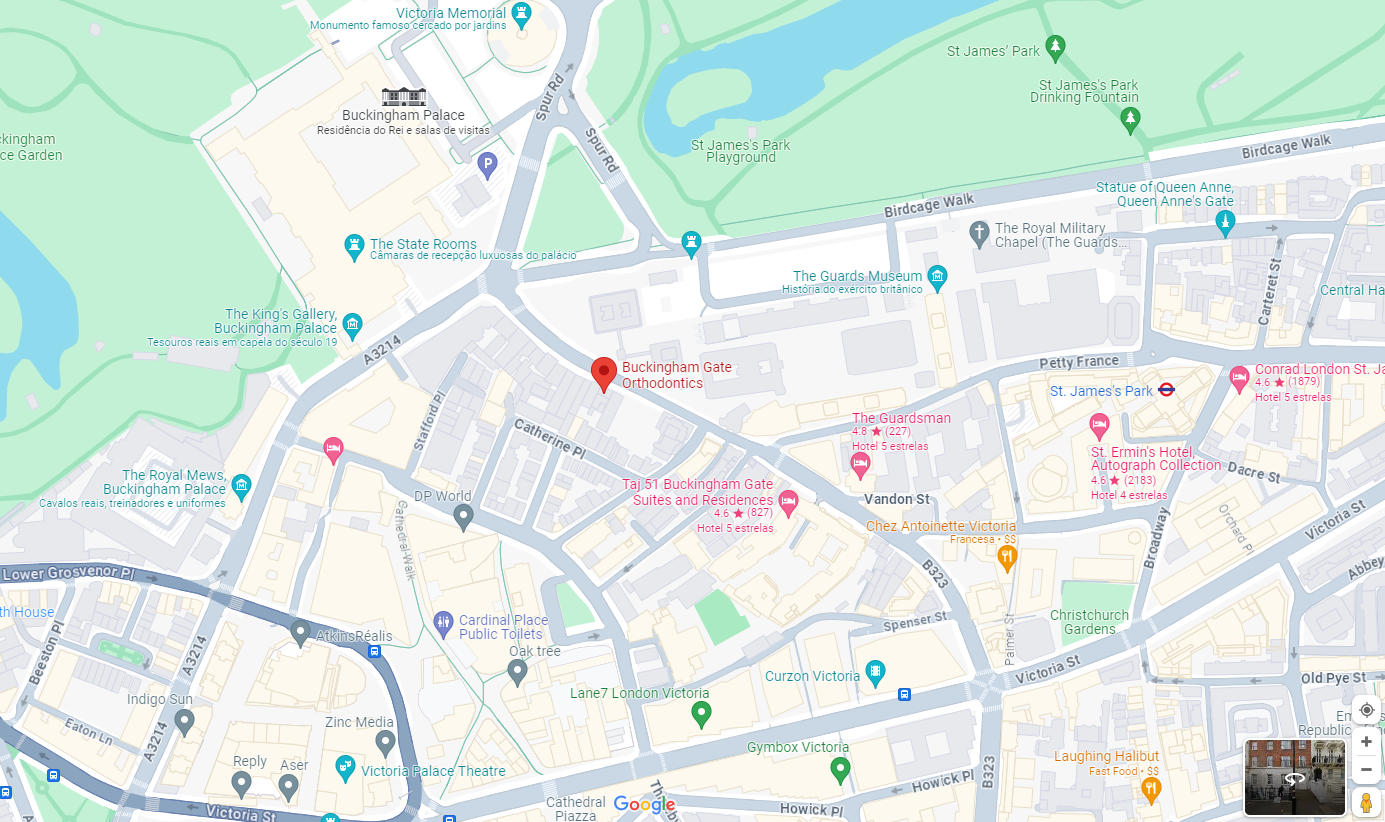Invisalign in London