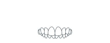 Invisalign in London
