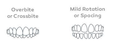 Invisalign in London