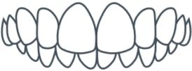 Invisalign in London