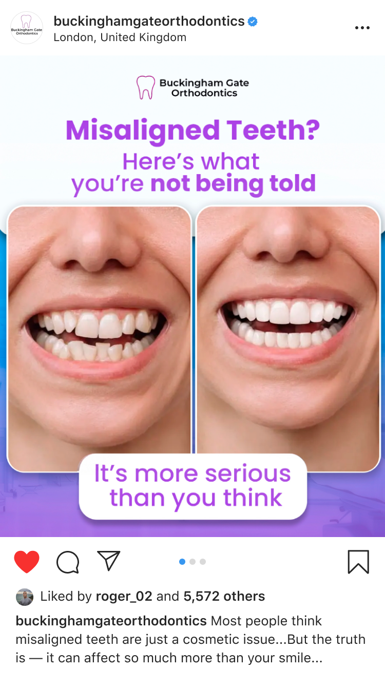Affordable Braces in Miami – Miami Bay Oral Health